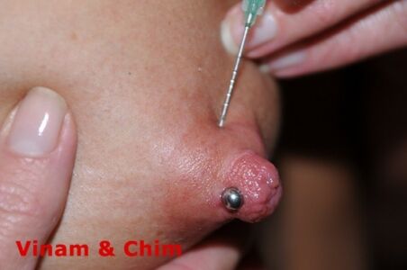 Vinam-cervix-peehole-needles-anal-fisting-nettles-bdsm-extreme-014