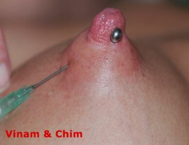 Vinam-cervix-peehole-needles-anal-fisting-nettles-bdsm-extreme-031