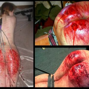 Photos of woman's butts spanked to blood.