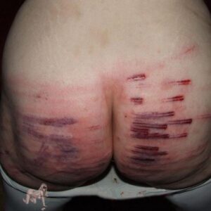 Whipped ass of chiennelassie, the real French lifestyle BDSM slavegirl.